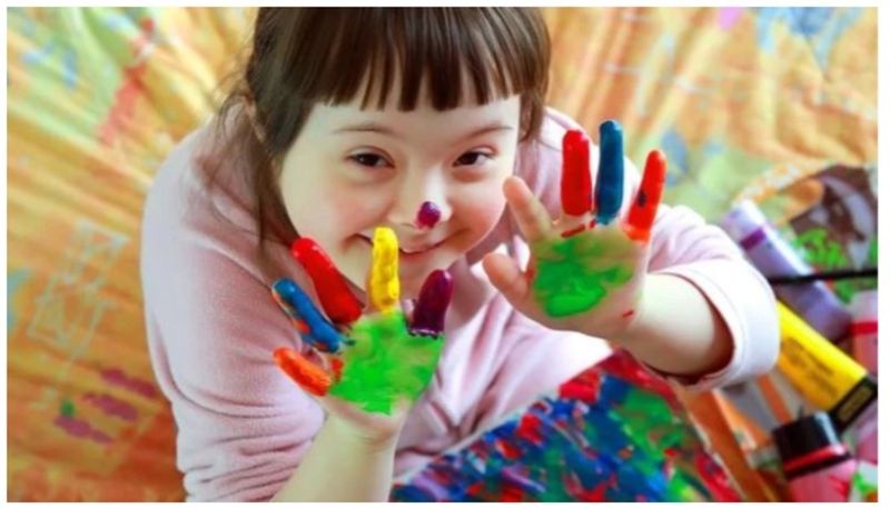 world down syndrome day down syndrome symptoms and causes