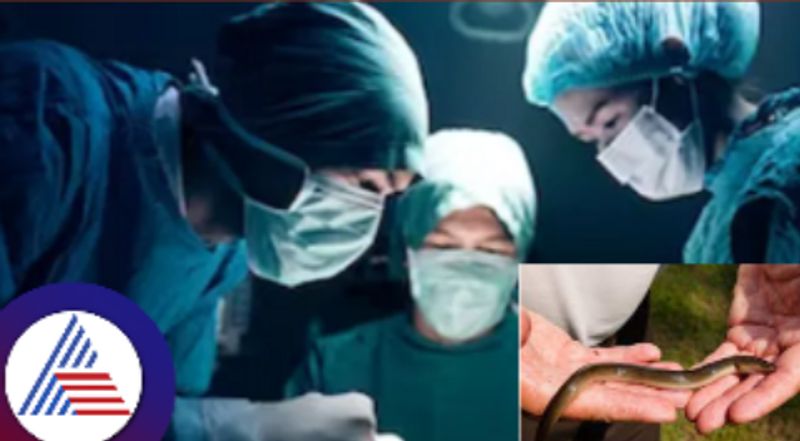 Man undergoes surgery to remove live eel from stomach skr