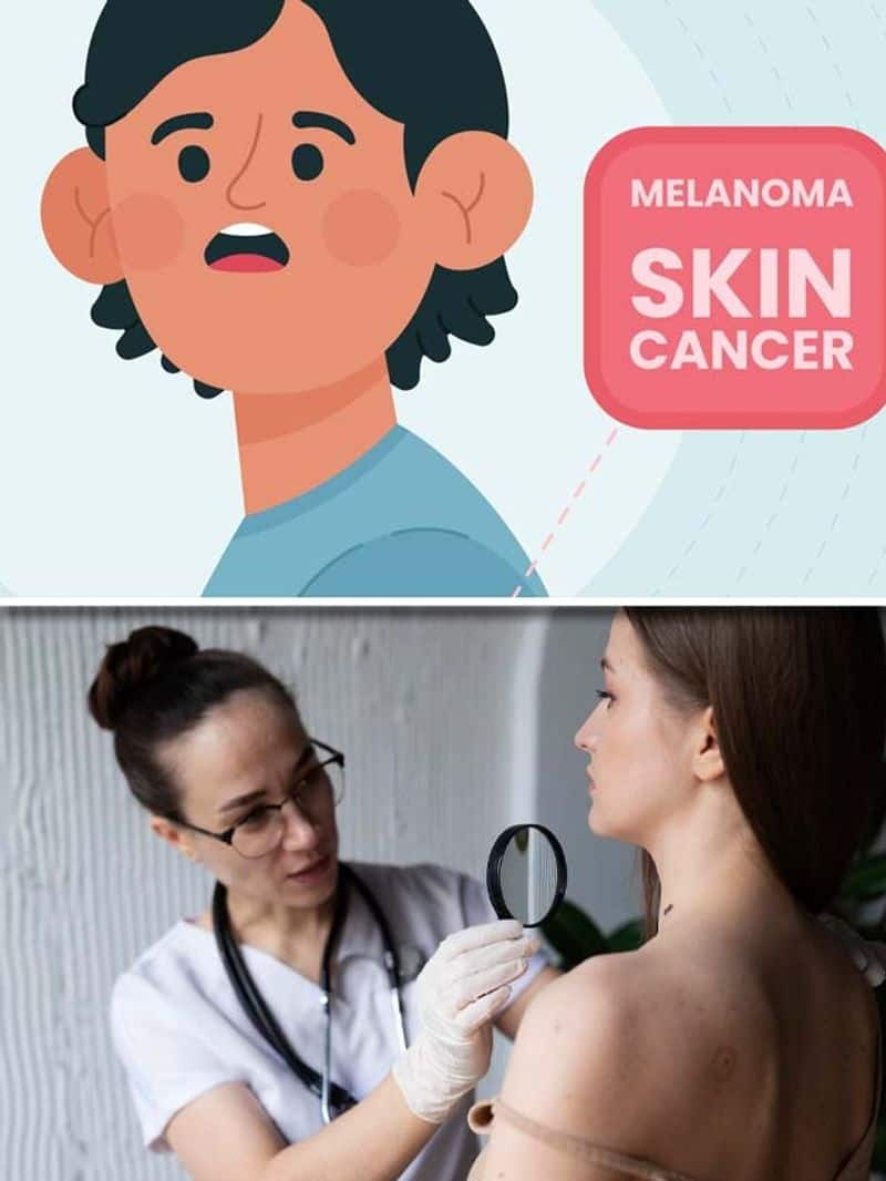 6 symptoms of skin cancer RKK EAI