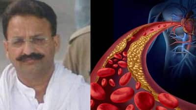 मुख्तार अंसारी की मौत का कारण था कार्डियक अरेस्ट, हार्ट अटैक और कार्डियक अटैक होती हैं अलग कंडीशन