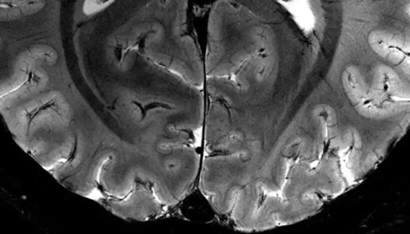 World's most powerful MRI scanner unveils groundbreaking insights into human brain function (WATCH)