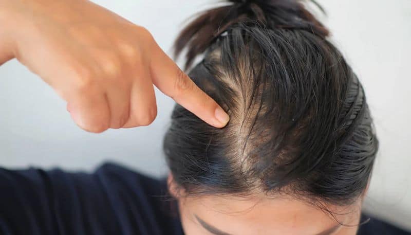 Hair growth to premature graying: Effective ways to use ghee for hair problems RTM