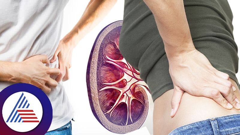 Do not ignore these small signs which are the symptoms of kidney stone pav