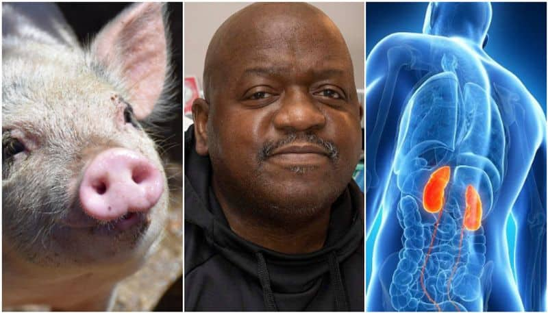 World first living patient underwent pig kidney transplantation discharged from hospital