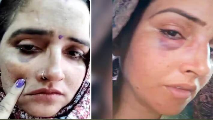 deep fake ai video of seema haider with swollen eye lip injury goes viral amid reports of a fight with husband Sachin KRJ