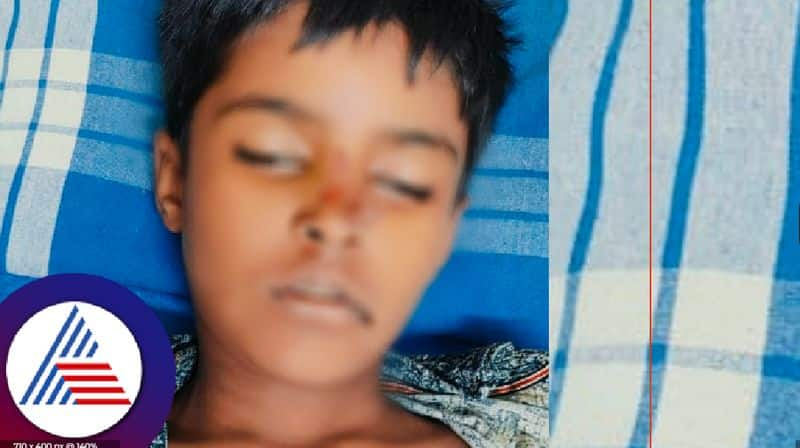 Misfire while playing with airgung 8-year-old boy dies at chikkamagaluru rav