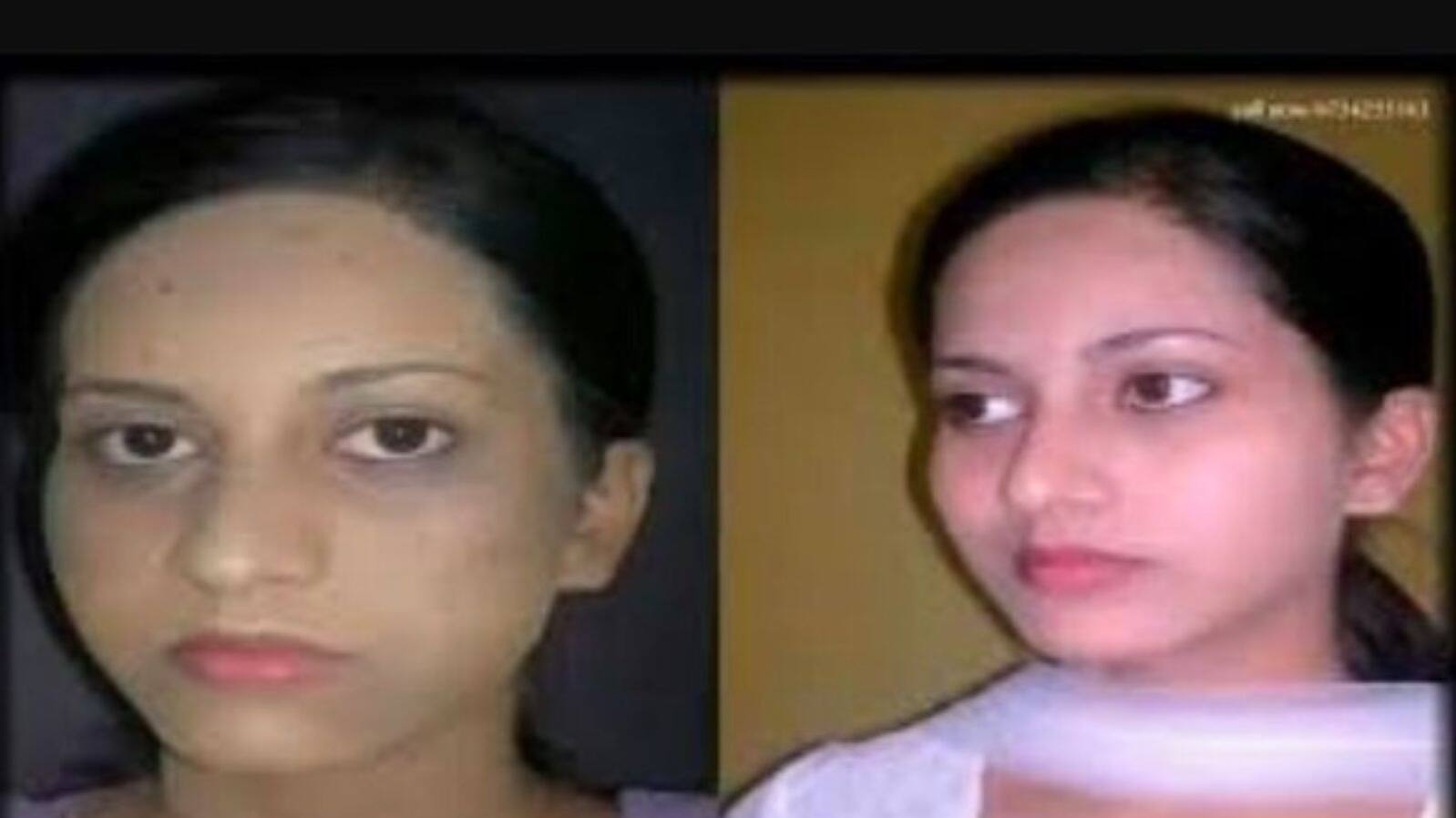 fairness cream 