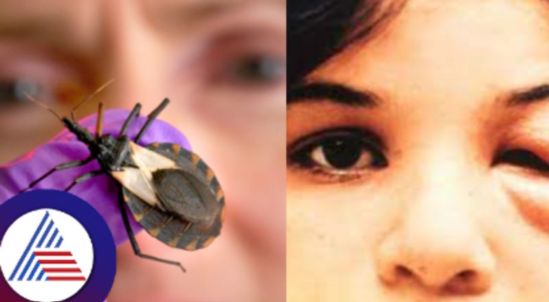 World Chagas Disease Day WHO calls for early detection for better health skr