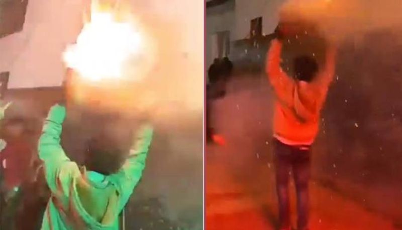 man dancing with firecrackers over head then this is happened 