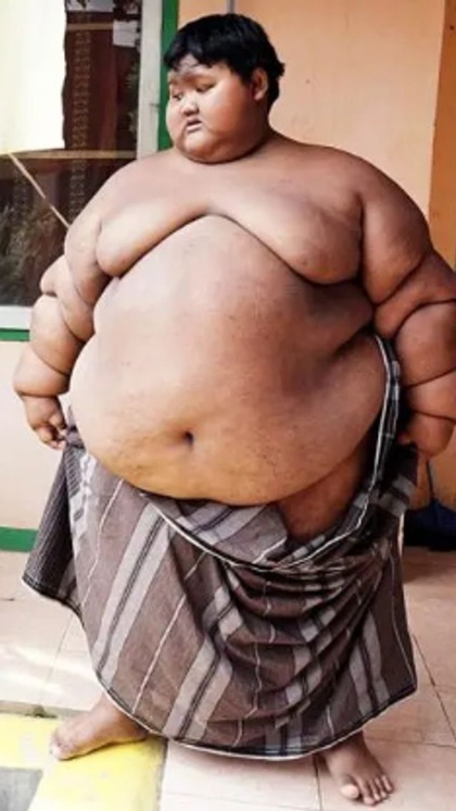 OMG! 10 साल के इस बच्चे ने घटाया 107KG वजन,अब पहचानना मुश्किल