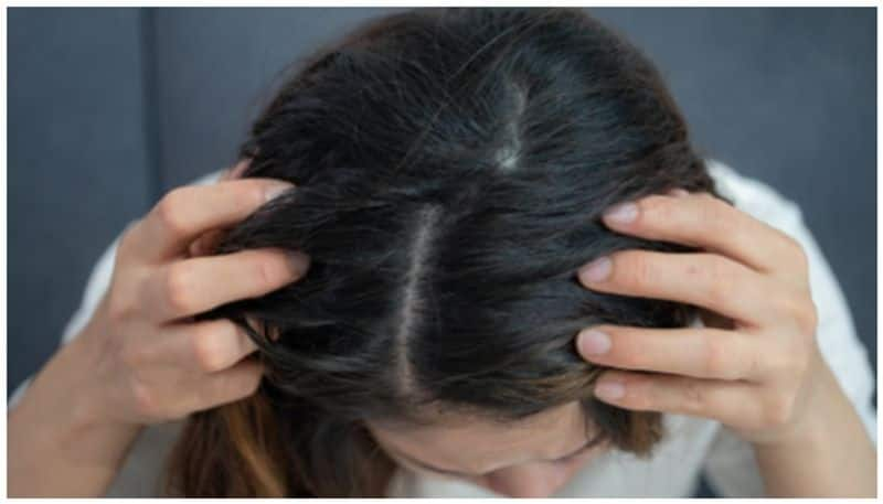 natural home remedies to prevent hairloss