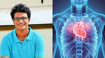 youtuber abhradeep saha Dies at 27  multi organ failure xbw