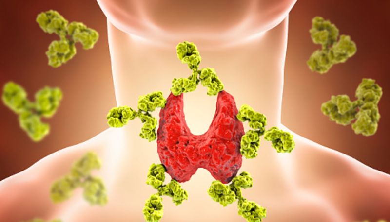 Navigating thyroid disorders: Understanding impact on Women's health ATG