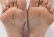 5 Ways to remove dead skin from feet zkamn