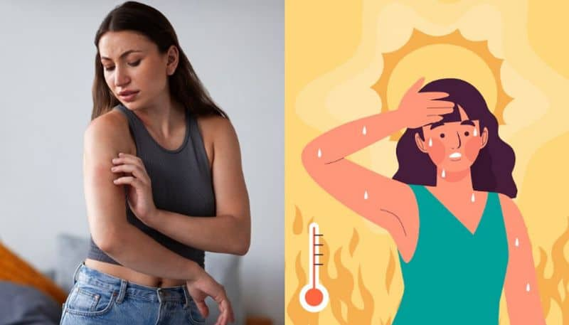 Heat rash to dehydration: BEWARE of these 6 summer skin problems RKK