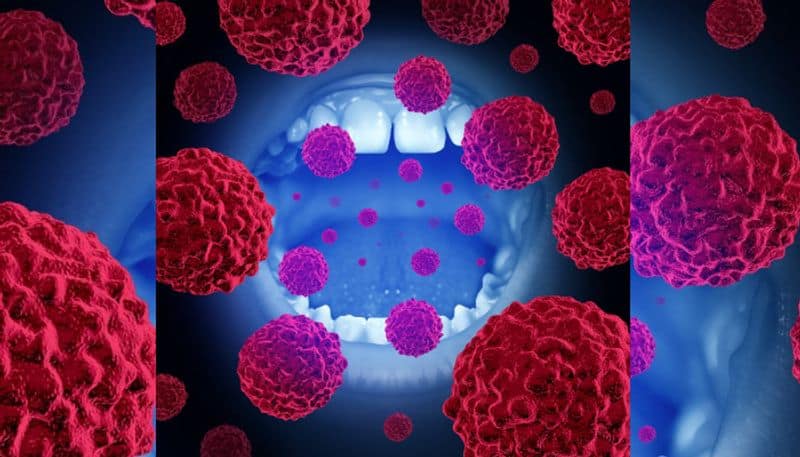 early signs of oral cancer common in patients