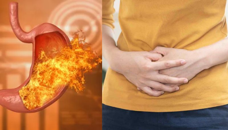 stomach ulcer