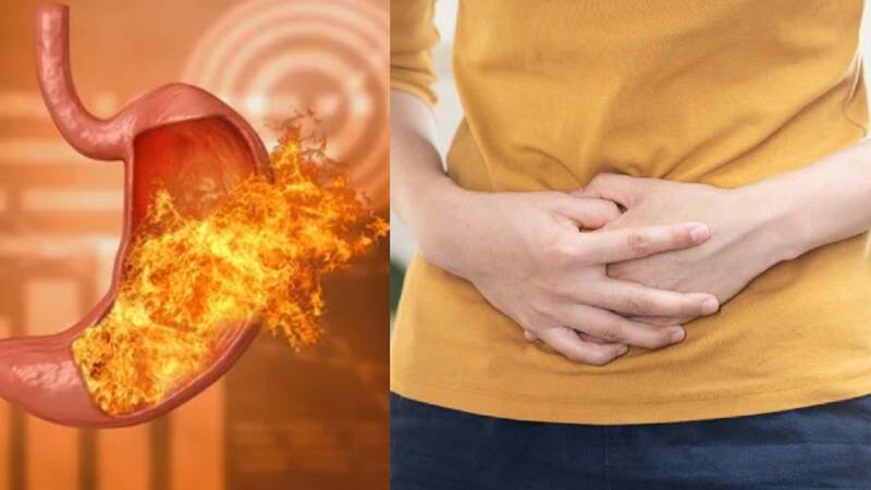 stomach ulcer