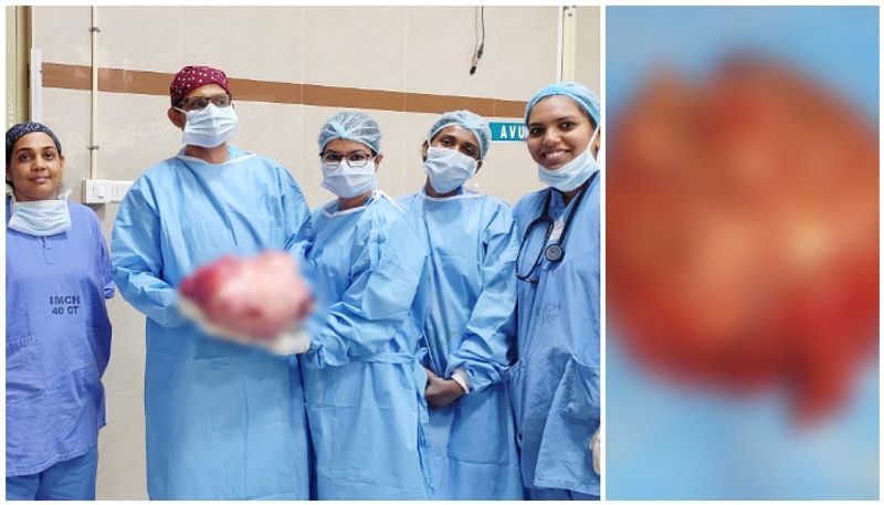 Kozhikode Medical College removed a tumor weighing more than 10 kg from the stomach of a young woman