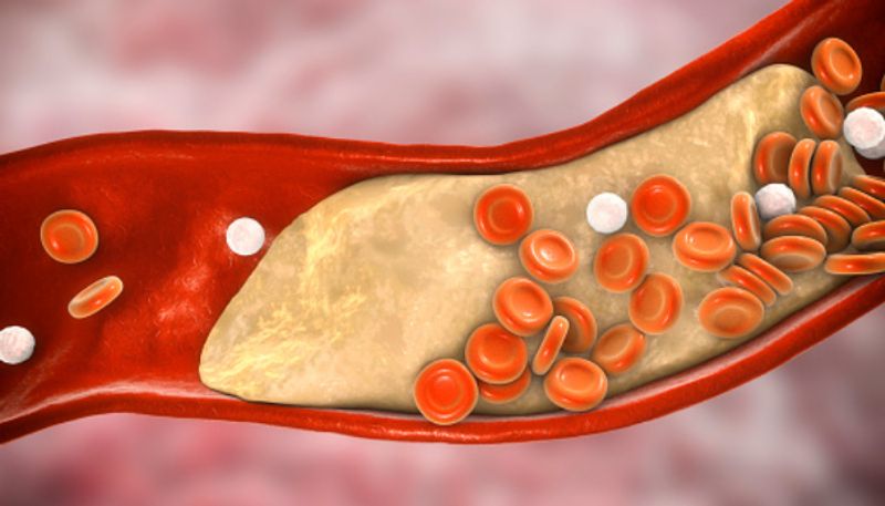 foods increase bad cholesterol levels