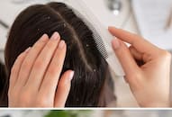 home-remedies-to-say-goodbye-to-dandruff