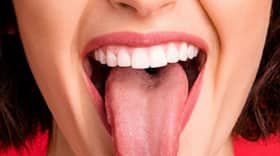 What Your Tongue Color Says About Your Health
