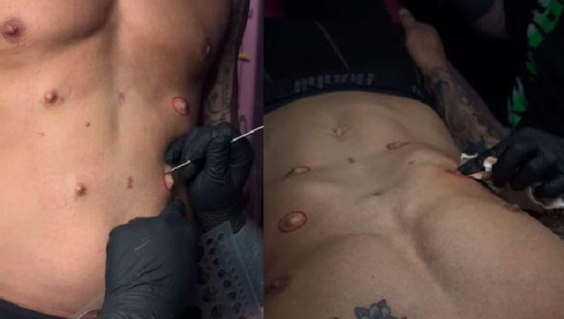 Man Surgically Adds Four Extra Nipples To His Body, Find Out Why Vin