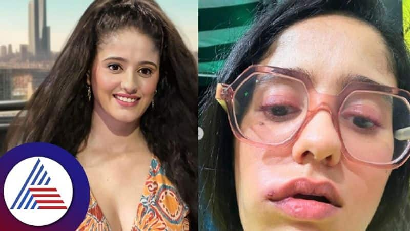 Ayesha Singh Opens Up About Her Swollen Face skr