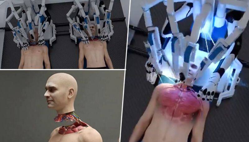 Worlds first head transplant system: US-based startup's spine-chilling, graphic video shocks Internet (WATCH) snt