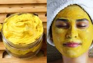 Tan removal to skin brightening: Try these DIY curd face masks for glowing skin this summer RTM 