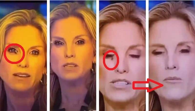 News anchor Vanessa Welch swallowed a fly mrq