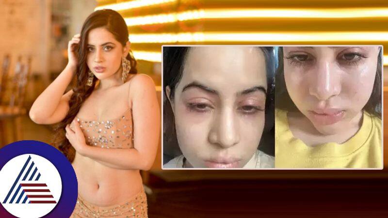 Uorfi Javed raises concern as she shares pictures says she is having  major major allergies suc