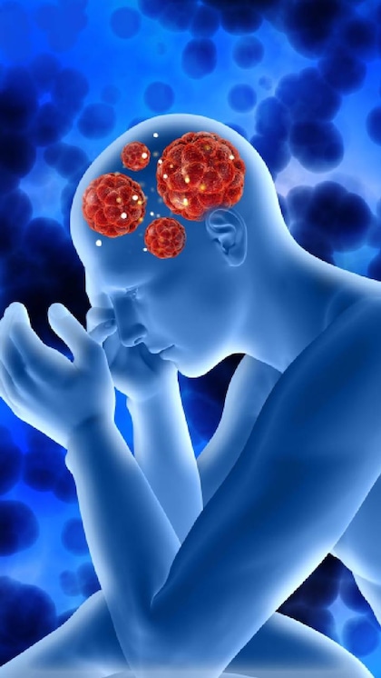 World Brain Tumour Day:ये फूड्स ब्रेन ट्यूमर की कर सकते हैं छुट्टी