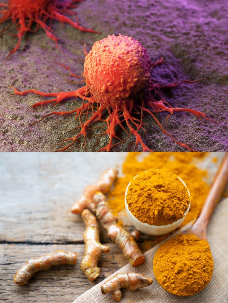 What spices and foods are good to prevent cancer? rsl