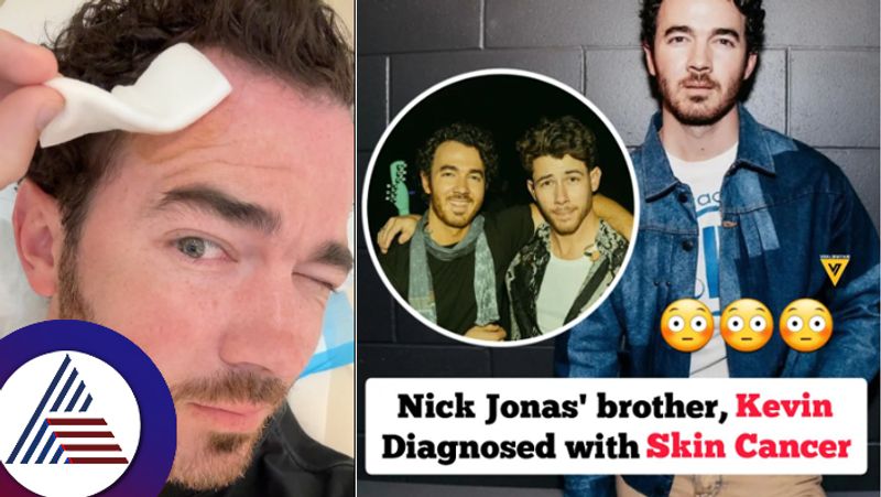 Nick Jonas brother Kevin Jonas shares skin cancer diagnosis through Instagram post suc