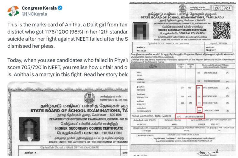 Kerala Congress party has posted a comment on social media against NEET examination mentioning the life of Ariyalur student Anitha vel