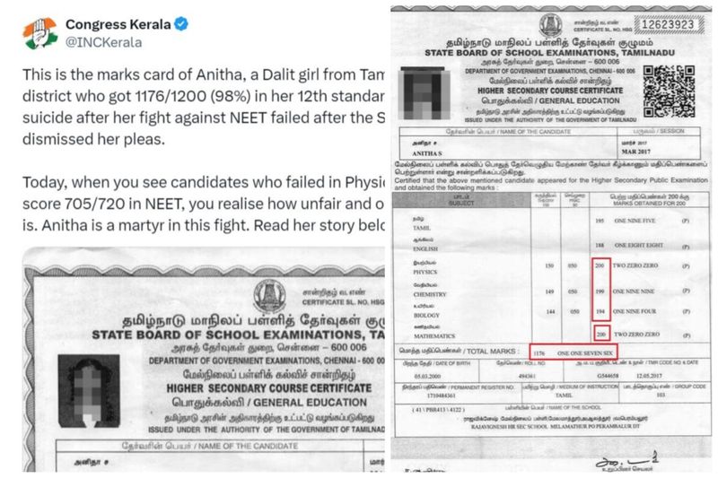 Kerala Congress party has posted a comment on social media against NEET examination mentioning the life of Ariyalur student Anitha vel