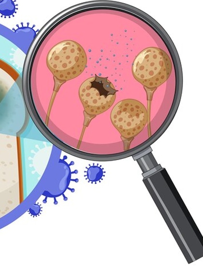 क्या है Deadly Fungal Infection? हर साल 37.5 लाख मौत, जानिए लक्षण