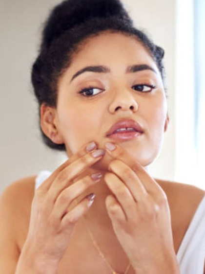 <p>स्किन पर गहरे दाग या गड्ढे बन सकते हैं।</p>
