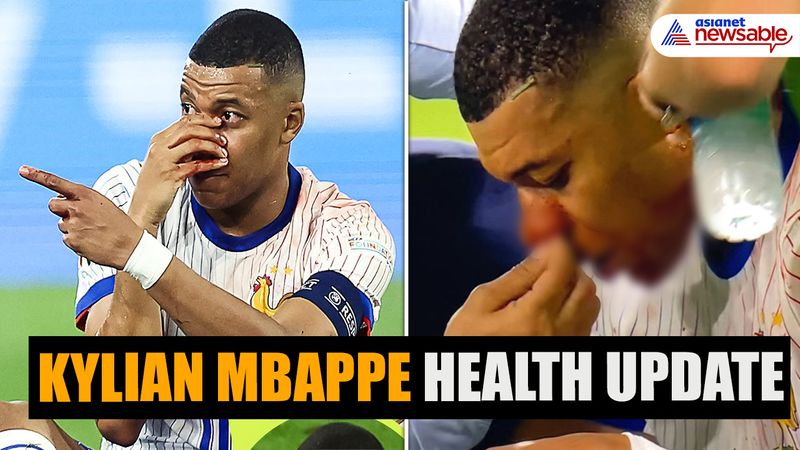 Euro 2024: Will Mbappe continue playing for France with broken nose? FFF president provides update osf