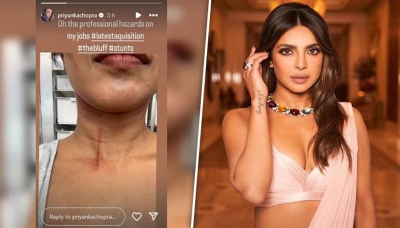 Priyanka Chopra gets injured while filming stunt, shares image of huge cut on her throat 
