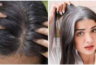 Youngsters have normalized premature grey hair, but why is it so common these days? RTM EAI