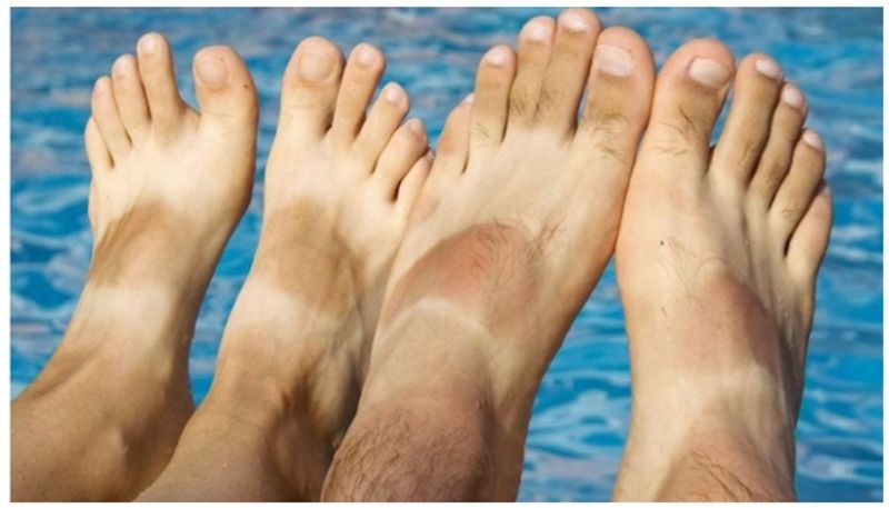 tips to remove sun tan in feet