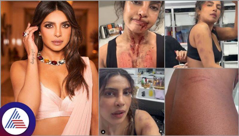 Priyanka Chopra stabbed neck and hand in the bluff movie shooting and runny blood nose sat