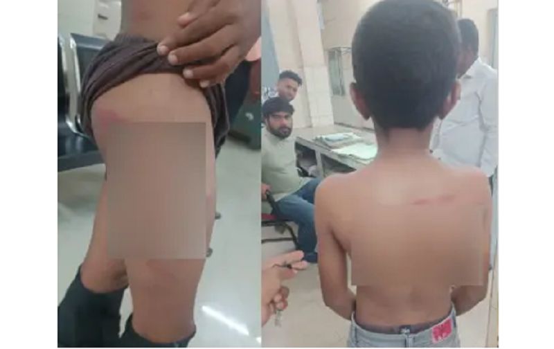 bidar teacher beat the student for not doing homework so that he got blood and bruises gvd