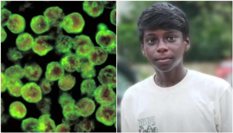 Kerala: Teenage boy dies of amoebic meningitis in Kozhikode; third death in two months anr