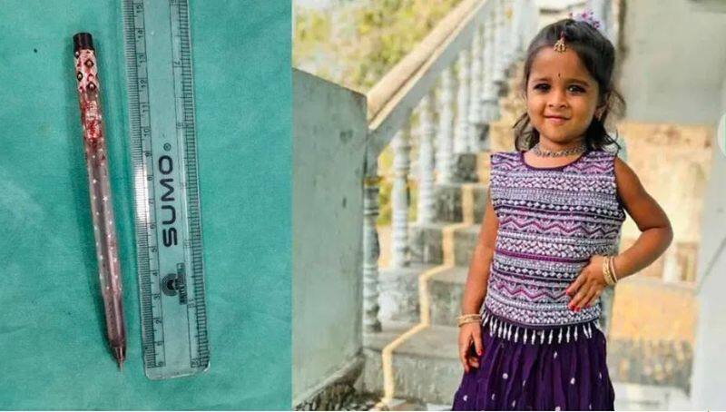 5 year old UKG child dies after Pen pierce her head while she sudden fell down while doing homework in Telangana's Bhadrachalam akb