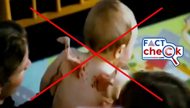 Fact Check a baby born with a pair of wings video is not real