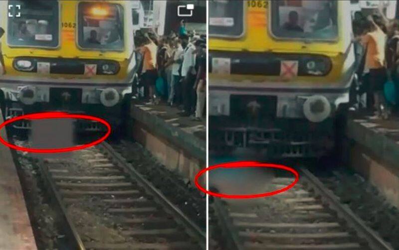 A woman who fell off a train in a rush both legs amputated In belapur station akb