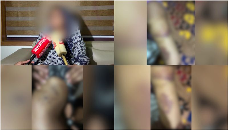 Another domestic violence case reported in Kerala's Malappuram; Woman brutally beaten for dowry by husband anr